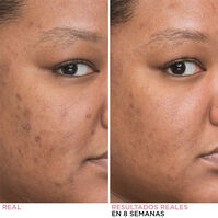 Bye Bye Dark Spots Concentrated Sérum  30ml-205827 Bye Bye Dark Spots Concentrated Sérum  30ml-205827 3